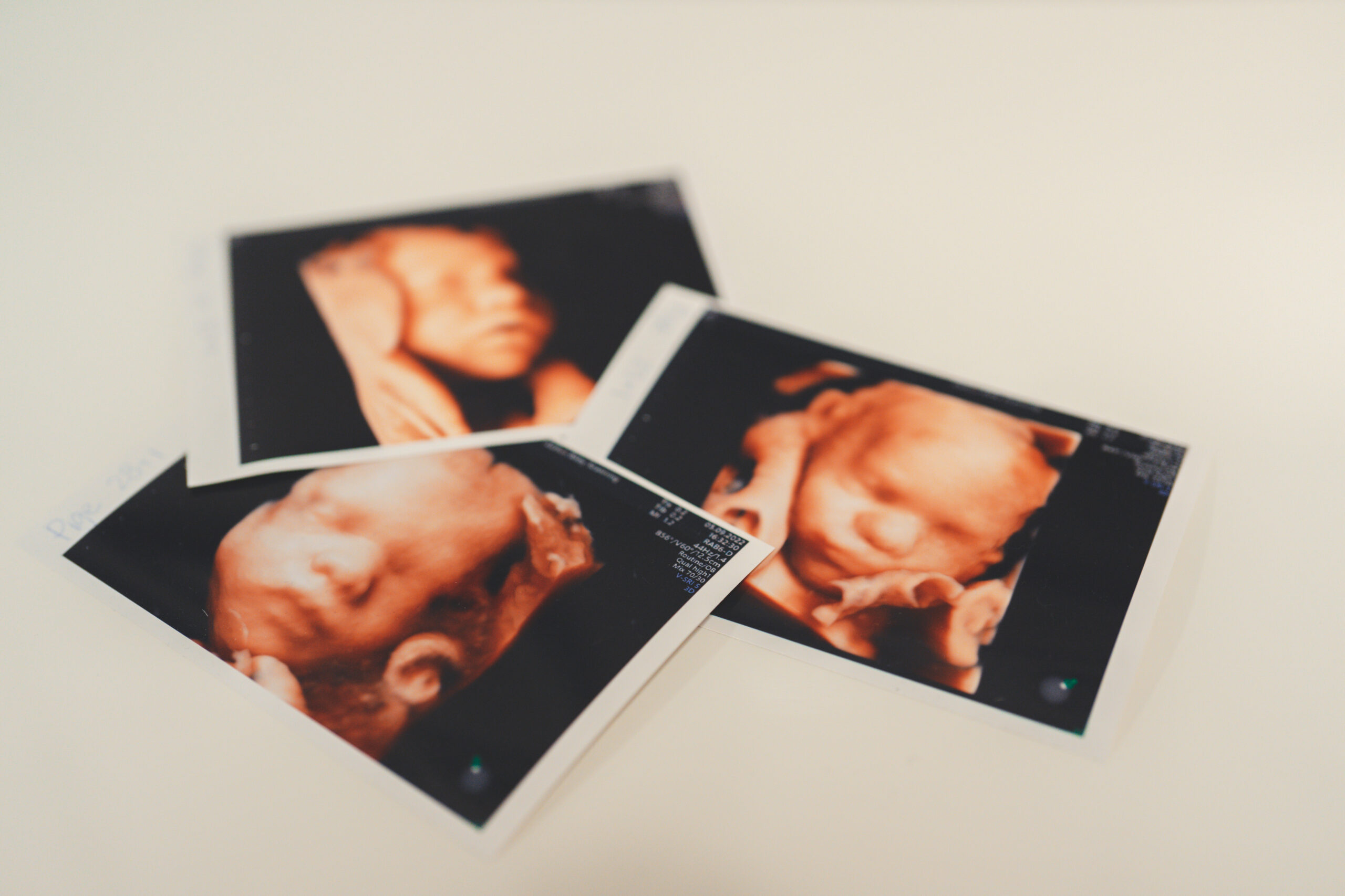 Se kønnet på din baby med en kønsscanning i Århus